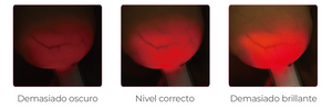 Dispositivo Luminous Breast Pro Series: Porque la detección temprana salva vidas 
