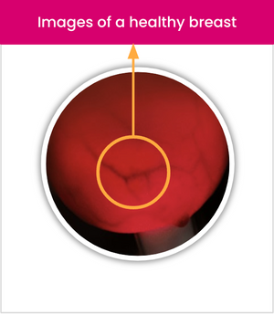 Dispositivo Luminous Breast Pro Series: Porque la detección temprana salva vidas 
